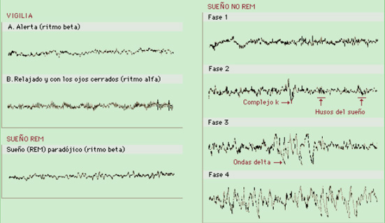 Actividad cerebral en el sueño.